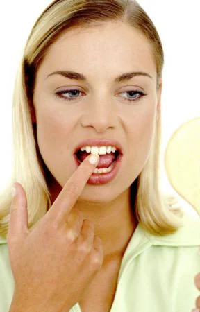 Tratamente naturale pentru dinţi mai albi