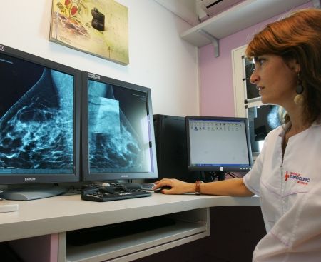 Cancerul la sân, depistat prin mamografii digitale