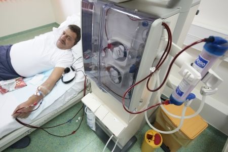 Două milioane de români afectaţi de boli de rinichi