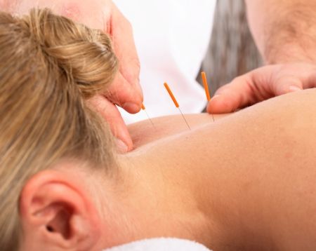 FAMILIE: Sarcină mai uşoară cu acupunctură