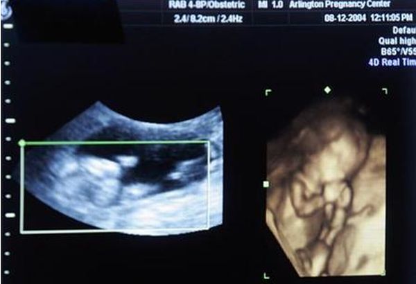 Gravidă abandonată de medici în timpul avortului. Reprezentanţii spitalului: "Medicul care era de gardă nu a greşit cu nimic"