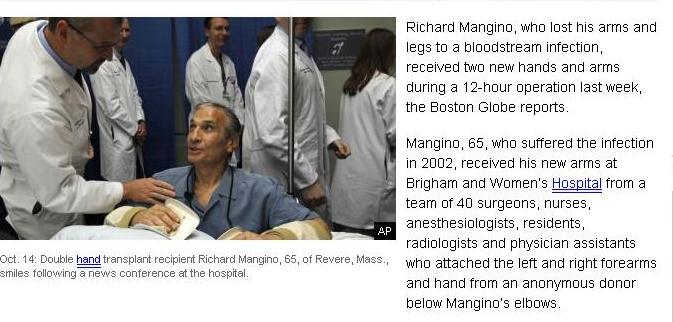 Transplant inedit la un spital din Boston. Un bărbat a primit două mâini noi