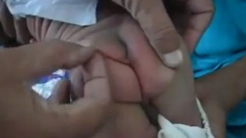 CAZ ŞOCANT. A născut un copil cu coadă. VIDEO cu 21 de milioane de accesări pe Youtube