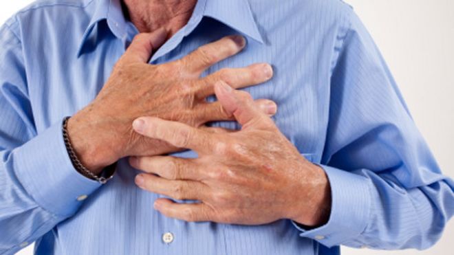 De ce apare infarctul? Cinci cauze neobișnuite
