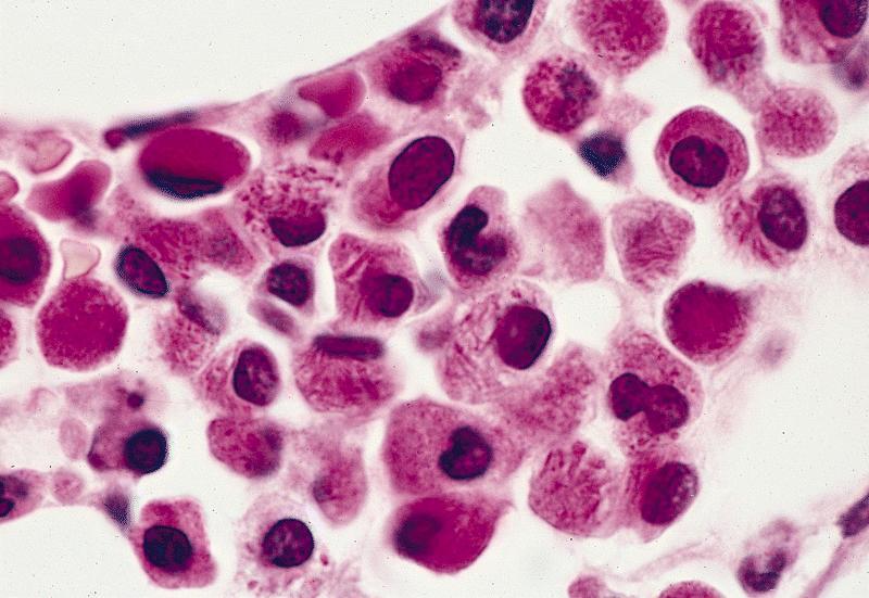 Leucemia poate fi cauzată de sistemul imunitar