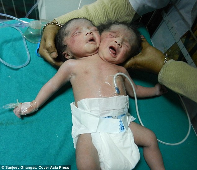 Doctorii sunt şocaţi. Acest copil tocmai s-a născut | VIDEO