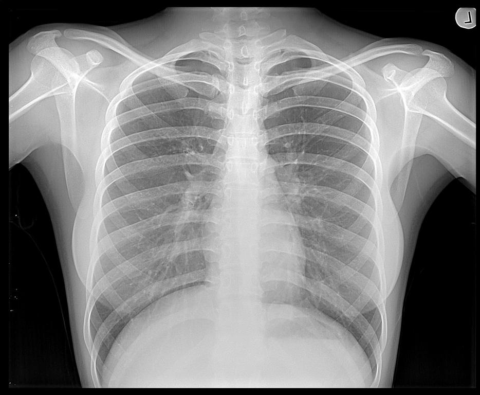 În ce condiții devin periculoase radiografiile