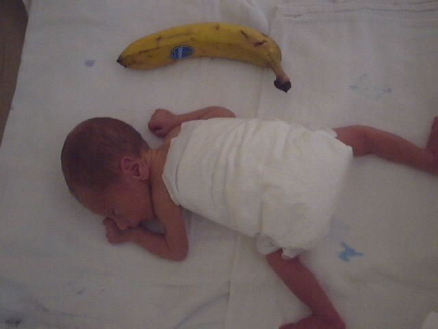 Povestea copilului „banană”. Prematurul de 1.300 de grame care a ajuns campion la karate