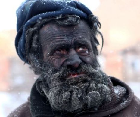 Acesta este cel mai murdar om din Europa? Un bărbat arde tot ce găseşte şi doarme în cenuşă | GALERIE FOTO