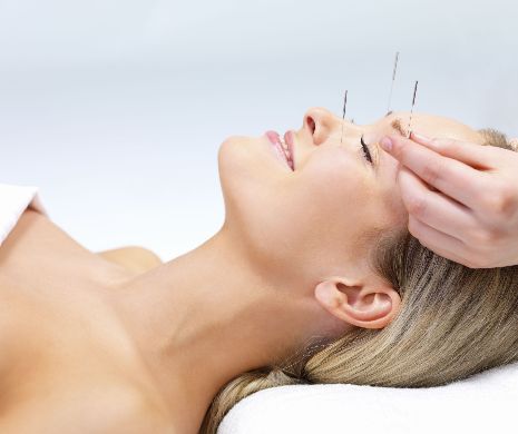 Boli care pot fi vindecate cu acupunctură