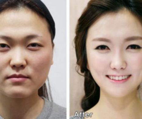 Operaţii estetice în Coreea de Sud. Femeile au nevoie de adeverinţă pentru că sunt de NERECUNOSCUT| FOTO