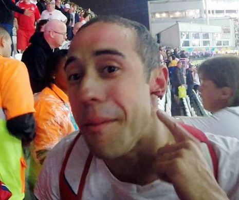 Cupa Mondială 2014. Imagini şocante cu un suporter britanic care a rămas fără jumătate din ureche.