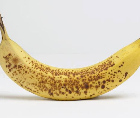 Bananele cu coaja pătată combat cancerul. Mit sau realitate?