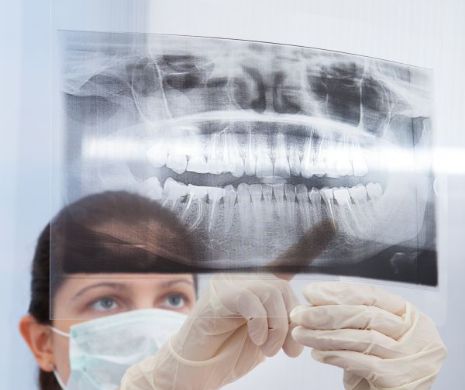 Inventatorii implantului care asigură mobilitatea asemănătore dintelui natural