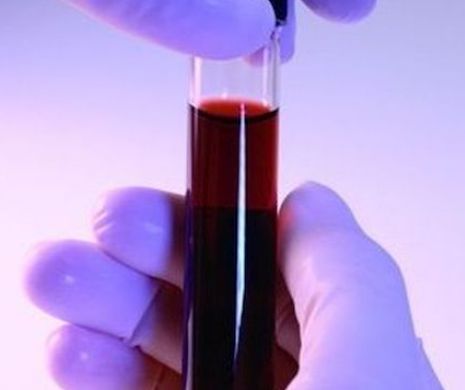 Test de sânge "universal" pentru cancer. Folosirea razelor ultraviolete în diagnosticare, o revoluţie în medicină