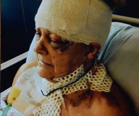 Bătrână LEGATĂ şi TORTURATĂ timp de trei zile de soţul NEBUN, care a atacat-o cu un TOPOR şi a dat FOC casei | IMAGINI ŞOCANTE