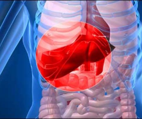 Hepatita C nu are simptome. Testarea anuală este principala măsură de depistare și de prevenire a complicaţiilor