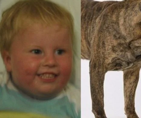 Băiețel mutilat de un câine fioros