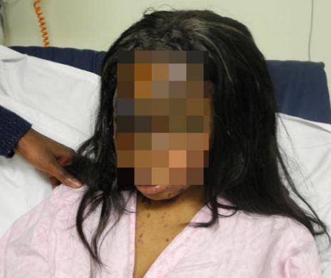 Orbit de GELOZIE, un OCTOGENAR a atacat-o cu ACID pe iubita lui ADOLESCENTĂ | FOTO