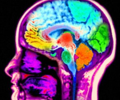 Cele mai bune metode să-ți menții creierul în formă și să te ferești de demență