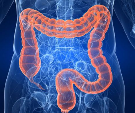 Nutrientul care previne cancerul de colon. În ce alimente se găsește?
