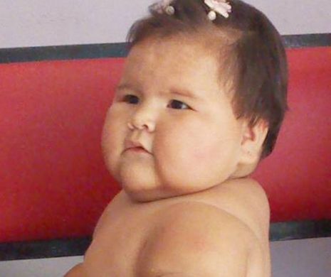 Cel mai obez copil de pe planetă. Cum arată fetiţa | FOTO