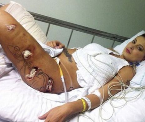 Implanturile de pe fund i s-au infectat și a stat o lună la reanimare.