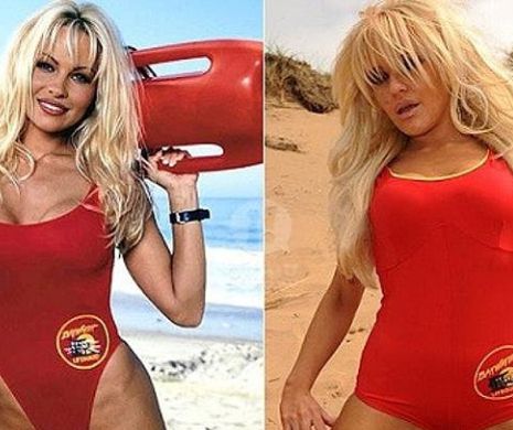 Silicoanele i-au EXPLODAT după ce a apelat la implanturi pentru a semăna cu Pamela Anderson. VEZI cum arată acum