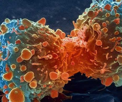Terapiile imuno-oncologice, un posibil leac-minune împotriva cancerului