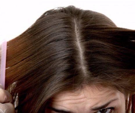 Ce boli anunță mătreața și albirea prematură a părului?