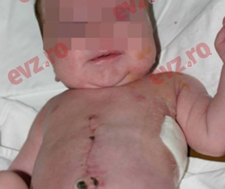 Chirurgul clujean care nu a fost lăsat să opereze un nou născut a salvat VIEȚILE altor șase copii. GALERIE FOTO cu un astfel de caz