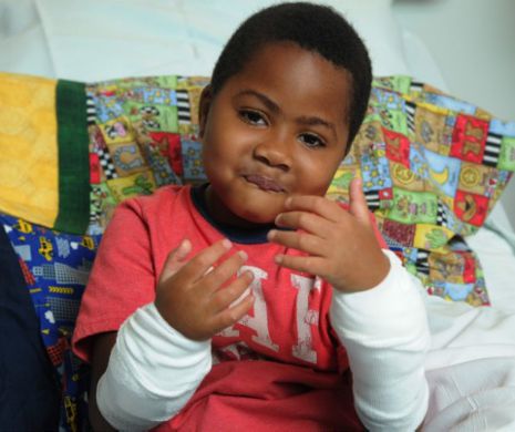 Cum arată băieţel căruia i-au fost transplantate ambele mâini FOTO şi VIDEO