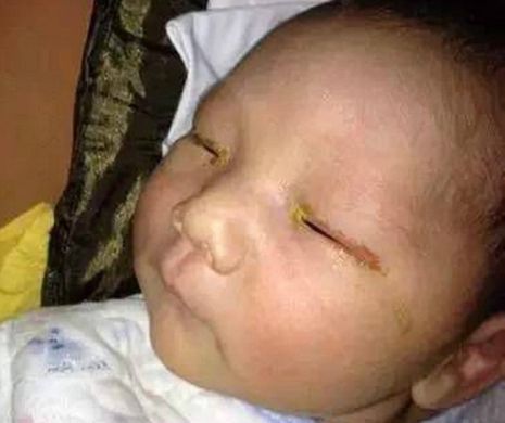 Un bebeluș a orbit din cauza blițului de la telefonul mobil cu care i-a fost făcută o poză