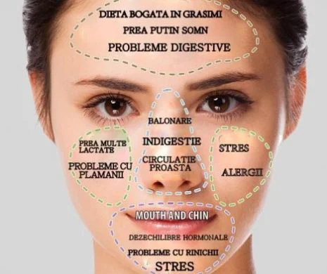 Ai coșuri pe frunte sau obraji? Zonele în care apare acneea îți arată de ce boli suferi
