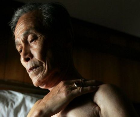 Japonezul care A SUPRAVIEŢUIT MASACRULUI provocat de explozia BOMBEI ATOMICE: a rătăcit trei zile fără ţintă, cu fâşii din propia carne atârnând moarte din trupul lui | Galerie FOTO