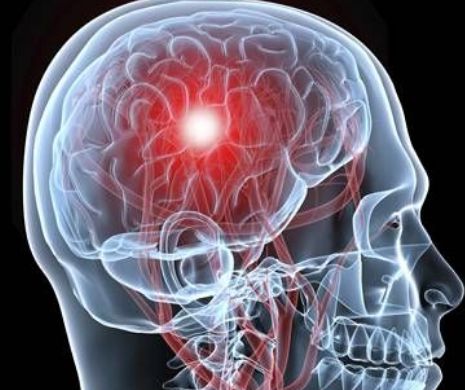 Simptomele care anunță cancerul la creier