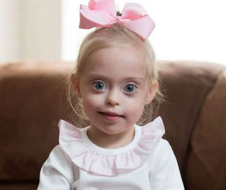 Are doi ani şi sindromul Down, dar a cucerit Marea Britanie cu zâmbetul ei. Gingăşia acestei fetiţe îţi va atinge inima | Galerie Foto
