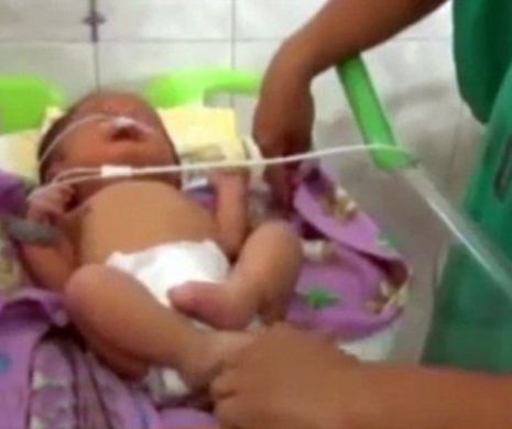 În Peru s-a născut un copil cu CHIP de EXTRATERESTRU. Medicii caută explicaţii pentru situaţia BIZARĂ