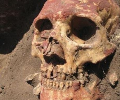 O boală cumplită a apărut cu 3000 de ani mai devreme decât se credea