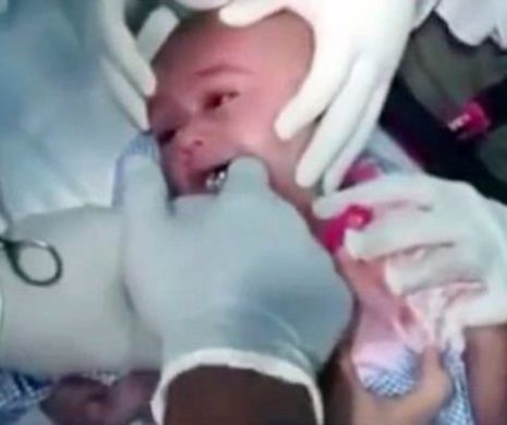 Imaginile sunt absolut incredibile. Ce au scos medicii din gura acestui bebelus. VIDEO