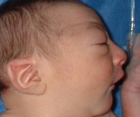 Alerta in SUA, dupa ce un bebelus s-a nascut cu capul anormal de mic. Cea mai mare frica a autoritatilor se poate adeveri