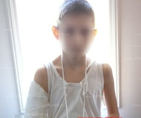 Un copil de 11 ani din Bârlad a ajuns la spital cu mâna ruptă după ce profesorul de sport l-a pus să se bată cu un coleg