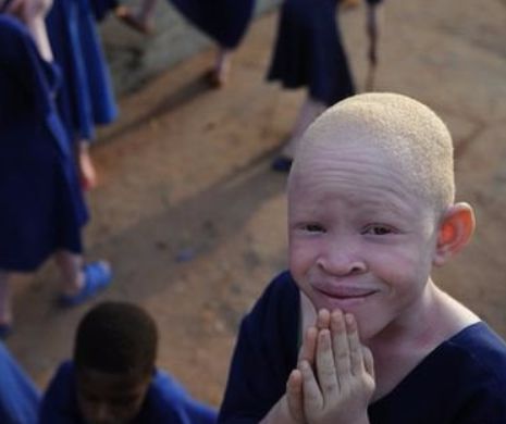 OBICEI oribil. Albinoșii riscă EXTINCȚIA pentru că SUNT UCIȘI și membrele le sunt tăiate ca să fie folosite la VRĂJITORIE