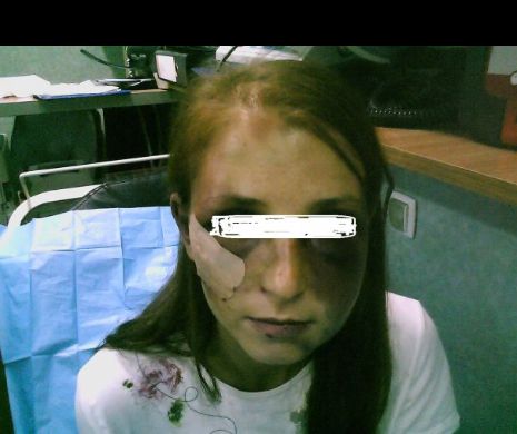 Justiție în România. Și-a sechestrat iubita, a bătut-o și i-a smuls părul din cap 22 de ore, și  NU FACE PUȘCĂRIE