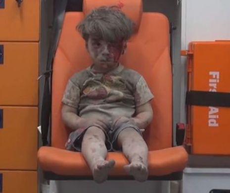 Imaginea unui băiețel rănit în Siria a stârnit emoții pe internet
