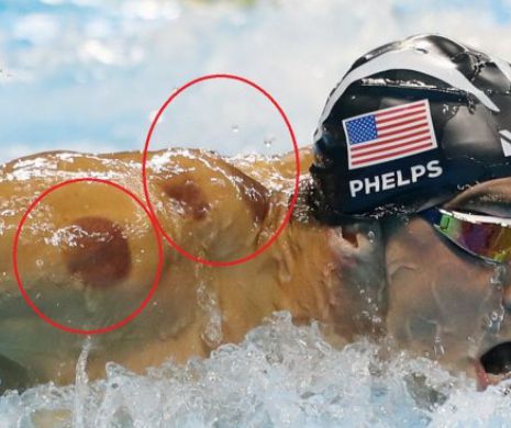 Michael Phelps, acuzat de DOPAJ la Rio! Rusii dezvaluie de la ce sunt urmele de pe umerii sai