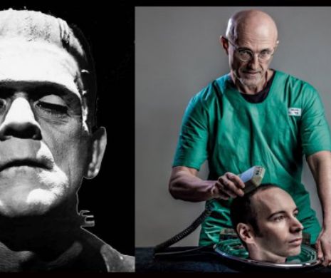 Tânărul al cărui cap va fi TĂIAT şi LIPIT de un alt CORP. “Doctorul Frankenstein” va face MINUNI în medicina modernă, putând face un om de 80 de ani să mai trăiască înca 40 | GALERIE FOTO