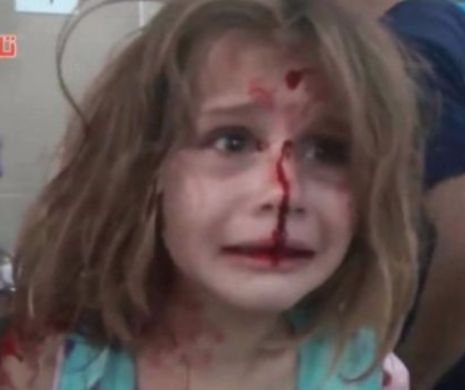 Imagini EMOȚIONANTE ce surprind ororile comise în SIRIA! O fetiță plină de SÂNGE plânge și își strigă cu DISPERARE tatăl
