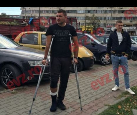 Un tânăr din Craiova sustine că a fost bătut crunt de poliţişti: „M-au lovit cu pumnii şi cu picioare. Am piciorul rupt“