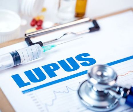 Lupus. Simptome